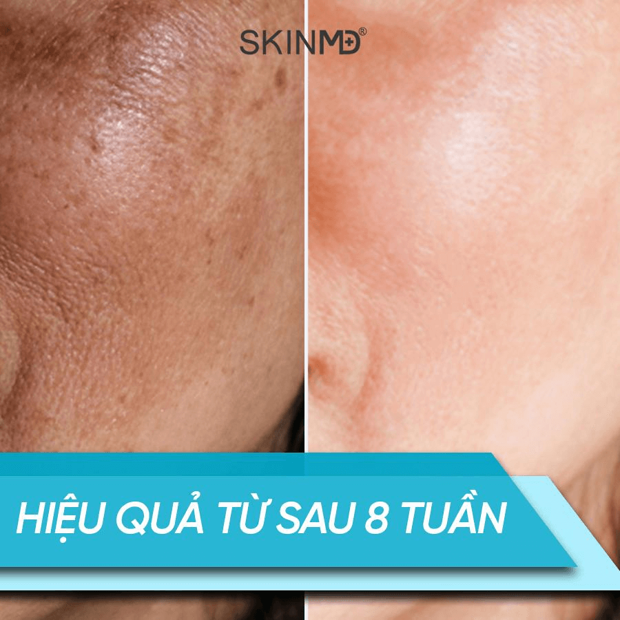 Làn da thay đổi rõ rệt sau 8 tuần